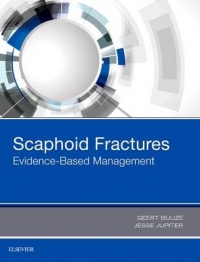 SCAPHOID FRACTURES EVIDENCE BASED MANAGEMENT