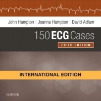 150 ECG CASES