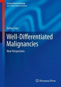 WELL DIFFERENTIATED MALIGNANCIES NEW PERSPECTIVES (H/C)