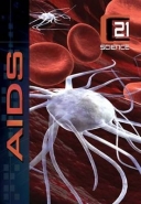 AIDS